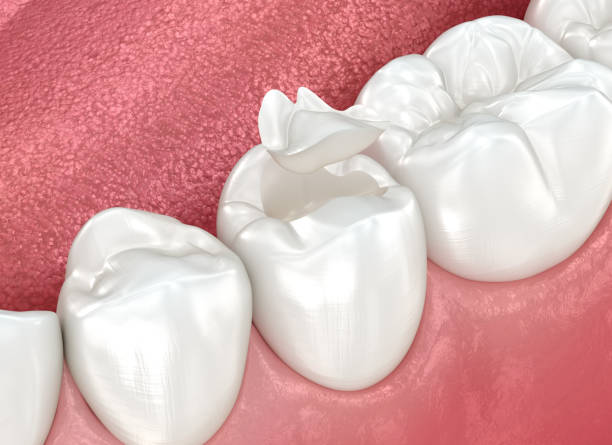 Our Range of Dental Services in Los Ranchos, CA